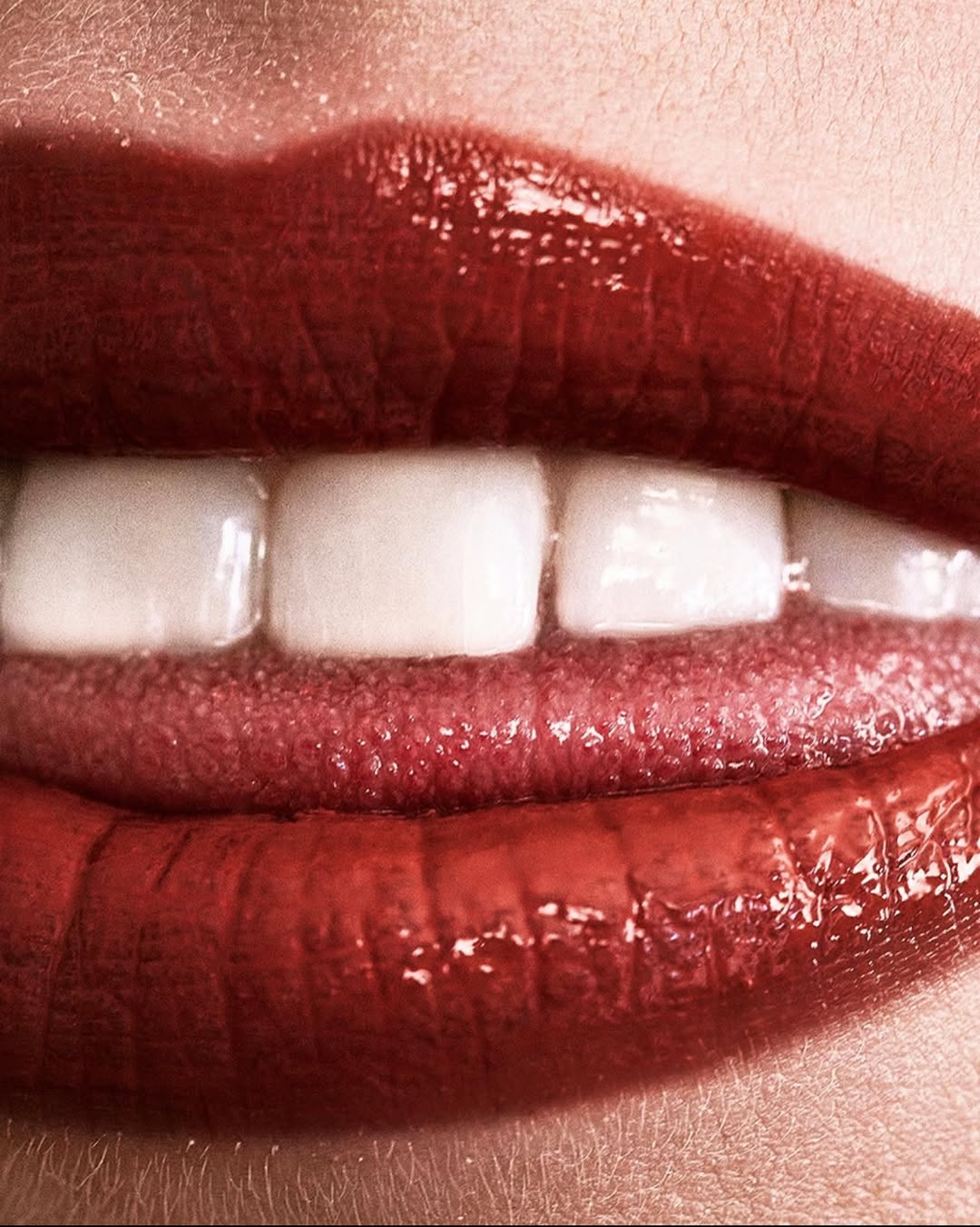 Kevin Larreguy Nov. 25