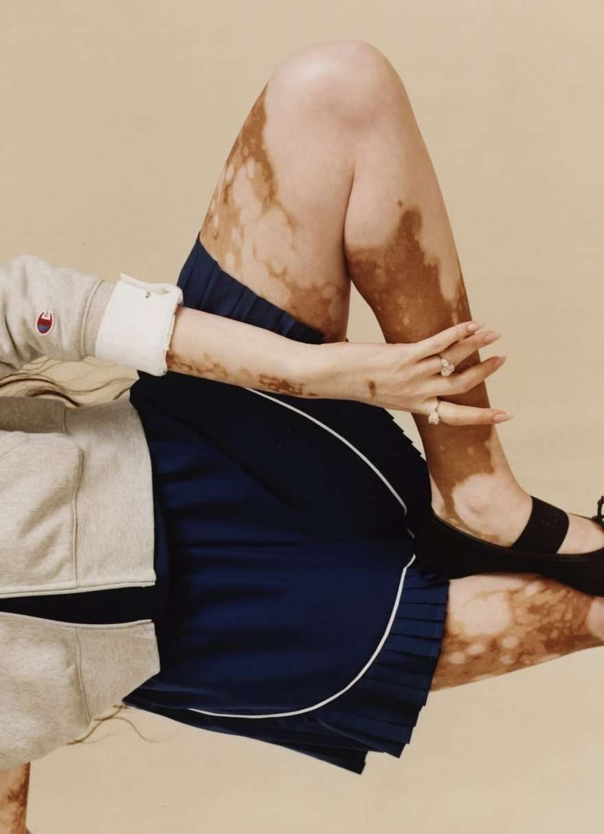 Darren Vargas X Champion