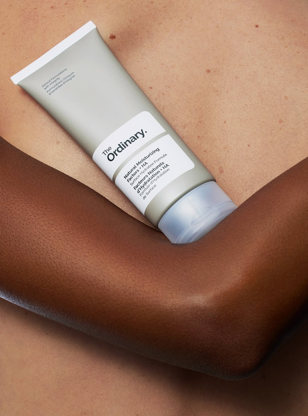 The Ordinary |  Feb. 26